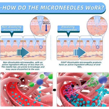 【Last Day Promotion 80% OFF🥇】𝗘𝗤𝗩𝗣® GLP-1 & NAD+ Slimming & health NANO MICRONEEDLE PATCH🇺🇸(Zero Pain. 24/7 Release | Lose 20lbs FAST | 90% Sugar Drop | )👨‍⚕️